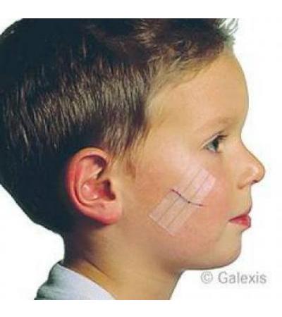 3M STERI STRIP 6X75MM WEISS VERSTÄRKT 50 X 3 STÜCK